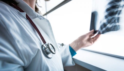 Як не сплутати  COVID-19 з туберкульозом